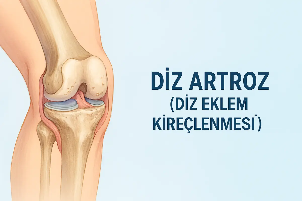 Diz Artroz (Diz Eklem Kireçlenmesi)