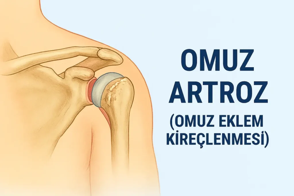 Omuz Artroz (Omuz Eklem Kireçlenmesi)