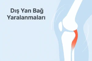 Dış Yan Bağ Yaralanmaları
