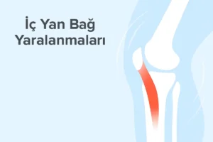 İç Yan Bağ Yaralanmaları