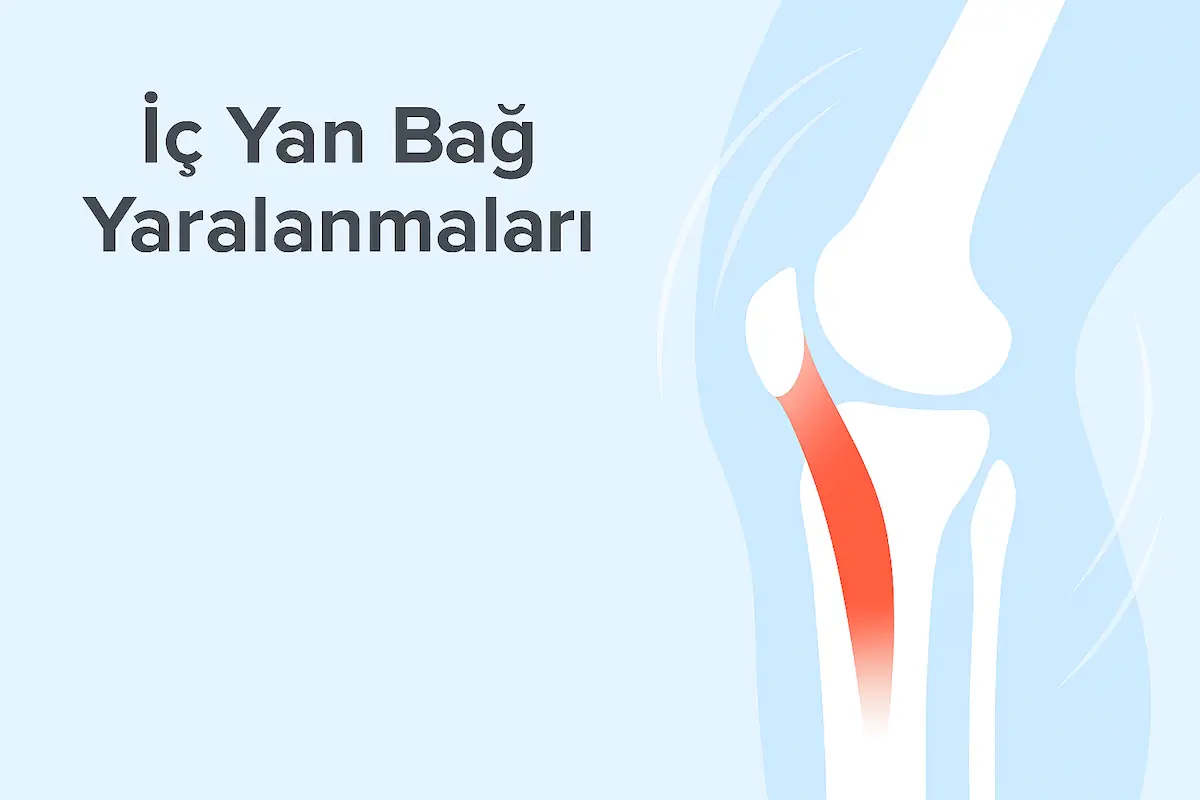 İç Yan Bağ Yaralanmaları