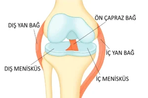 Diz bağ yaralanmaları hakkında detaylı bilgi alın. Belirtiler, nedenler ve tedavi seçenekleri, Ortopedi ve Travmatoloji Uzmanı Prof. Dr. Bülent Bektaşer