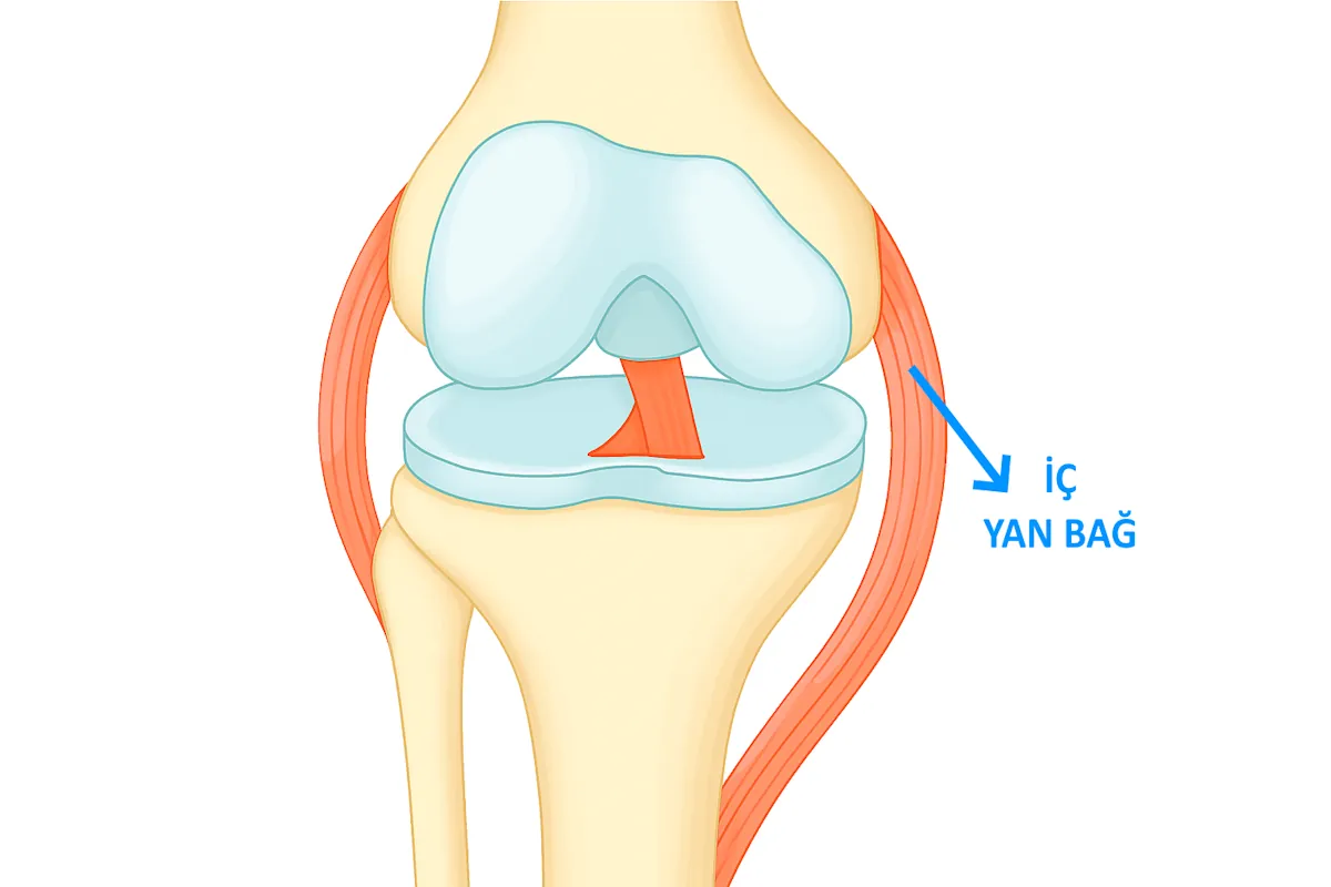 İç Yan Bağ Yaralanmaları